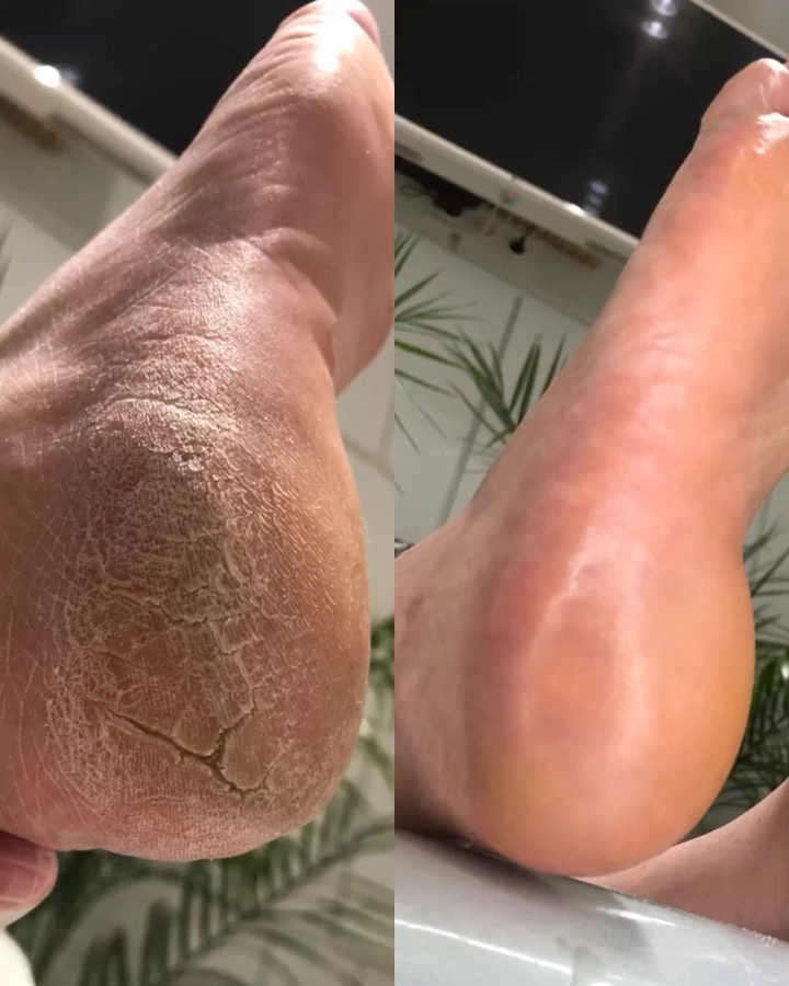 Beauté des pieds homme