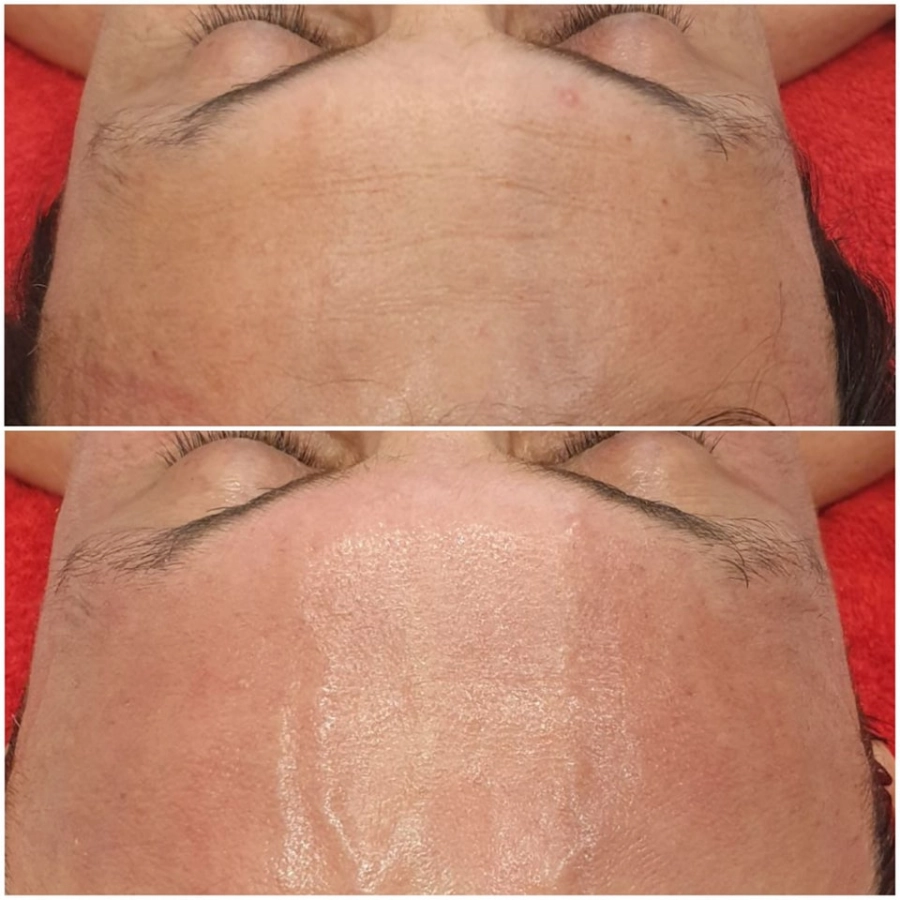 ANTI-ÂGE : Soin du visage Anti-âge longévité