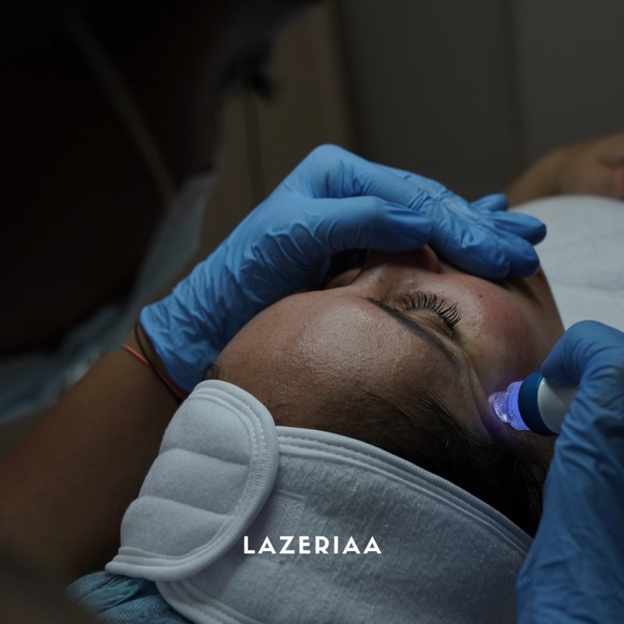 Soin du visage HydraFacial - 5 séances