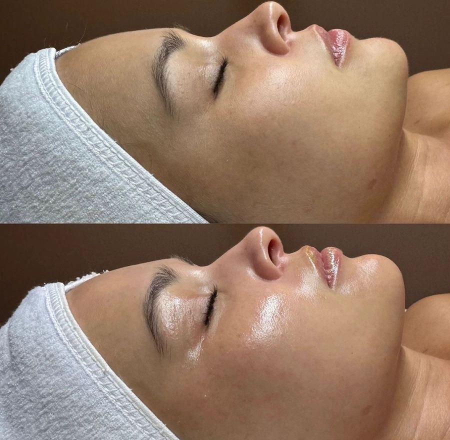 Soin du Visage By Phyt's