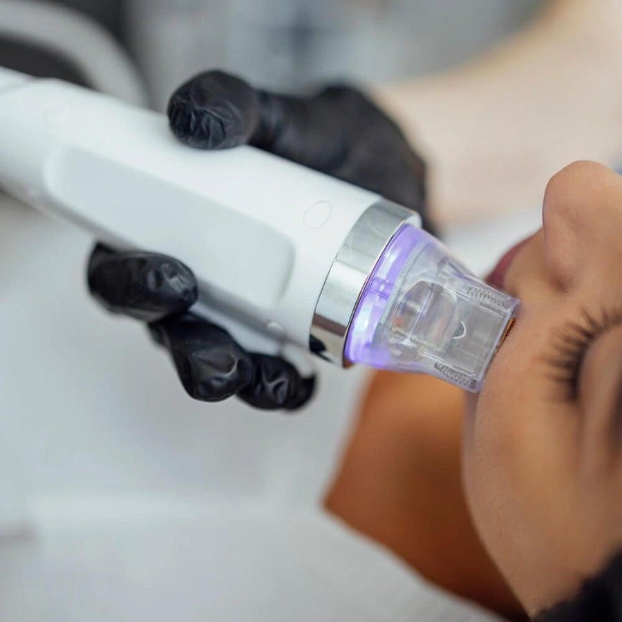 Microneedling Radiofréquence + LED