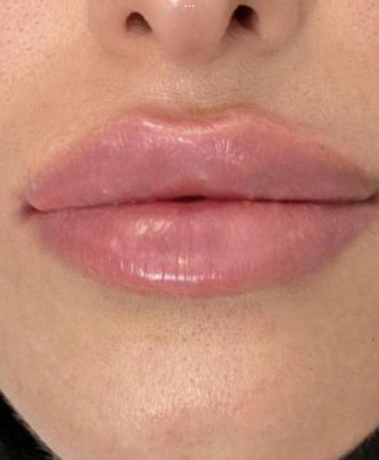 Retouche entretien 1an max