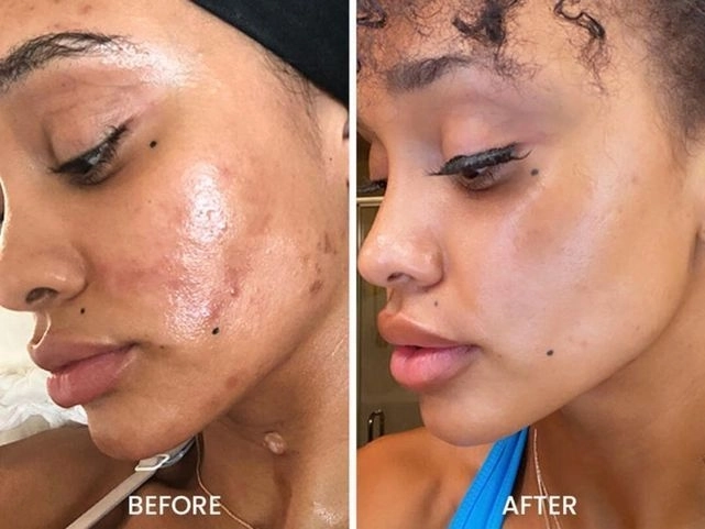 Gommage + masque éclat  express 