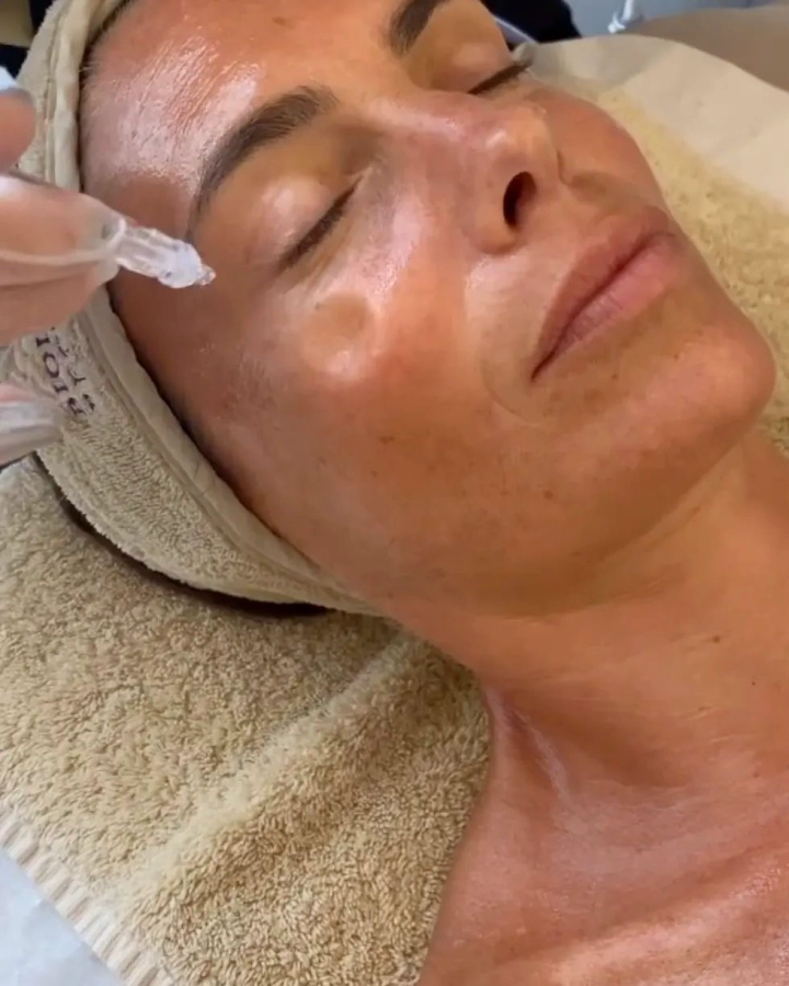 ÉCLAT : soin Peeling rénovateur de peau - peaux sensibles : HYDRA PEELING 