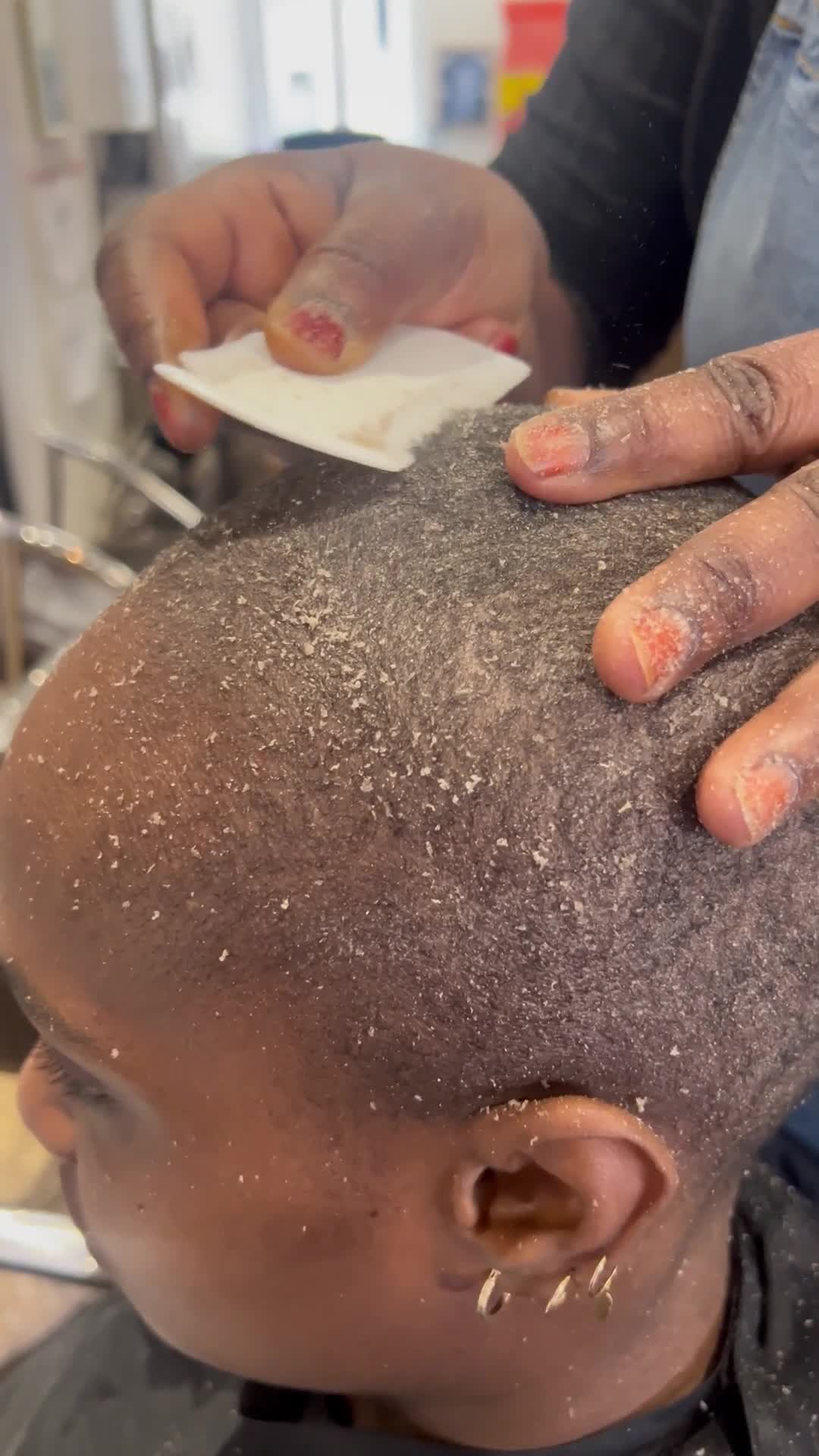 Grattage Cuir Chevelu ( Cheveux Rasés )