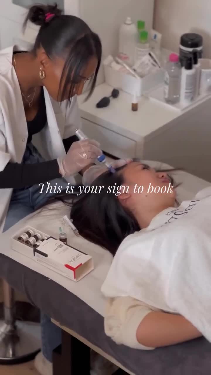 Microneedling Capillaire - Chute de Cheveux ( faire un shampoing avant de venir )