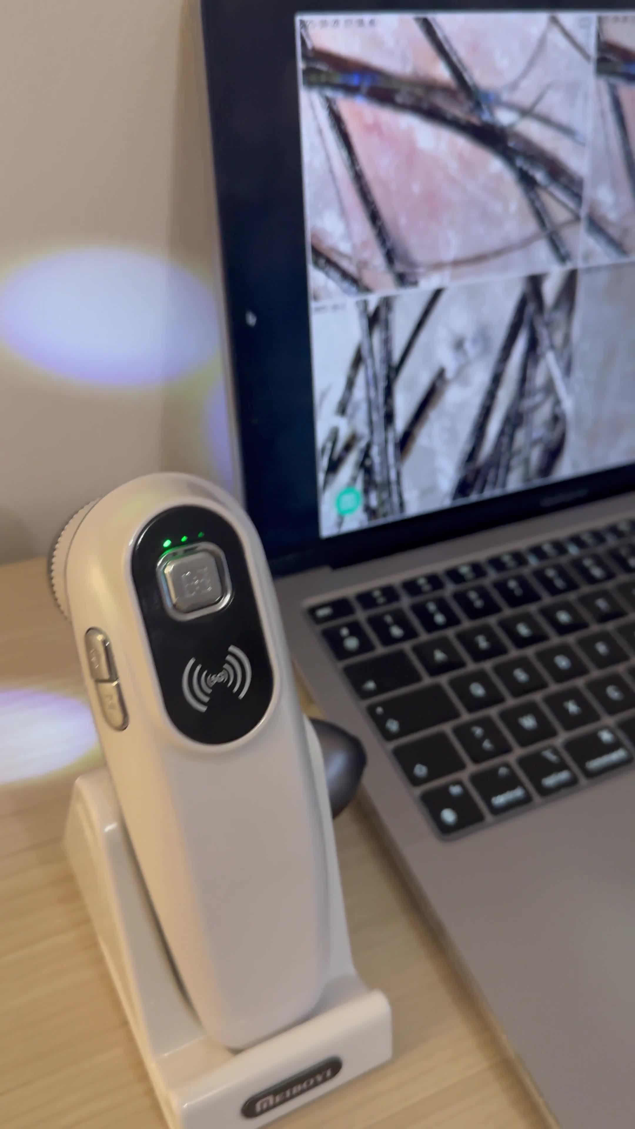 Diagnostic avec caméra (prévention, analyse)